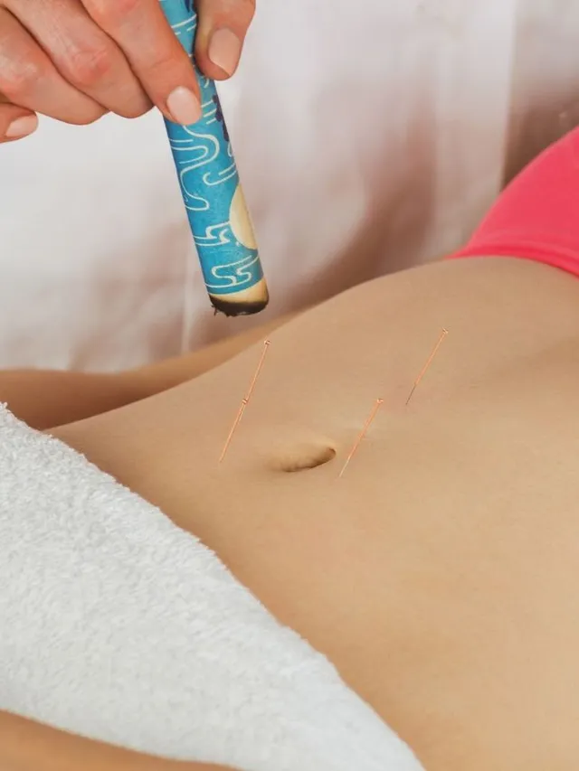 Woman receiving fertility acupuncture to restore hormonal balance and improve natural conception — holistic fertility treatment in Hamilton.